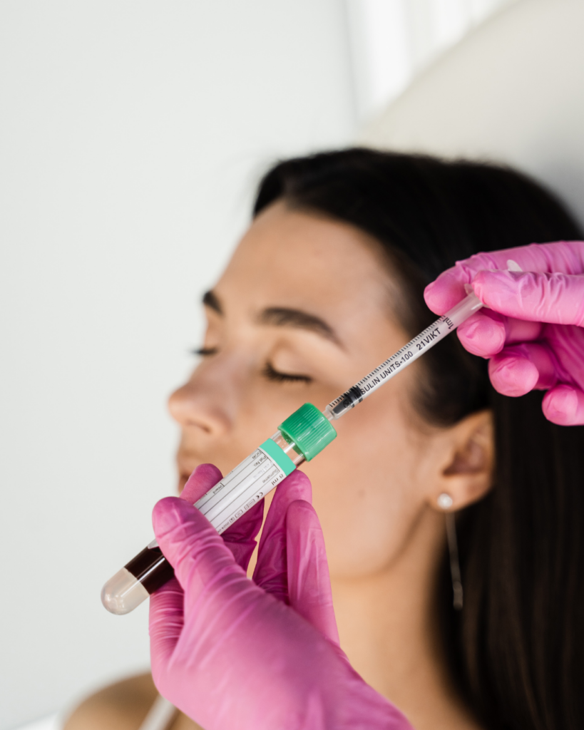 PRP facial rejuvenation treatment at LumiSKN Clinics
